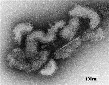 The Oz virus, transmitted by ticks. (Photo: Japan's National Institute of Infectious Disease (NIID) website)
