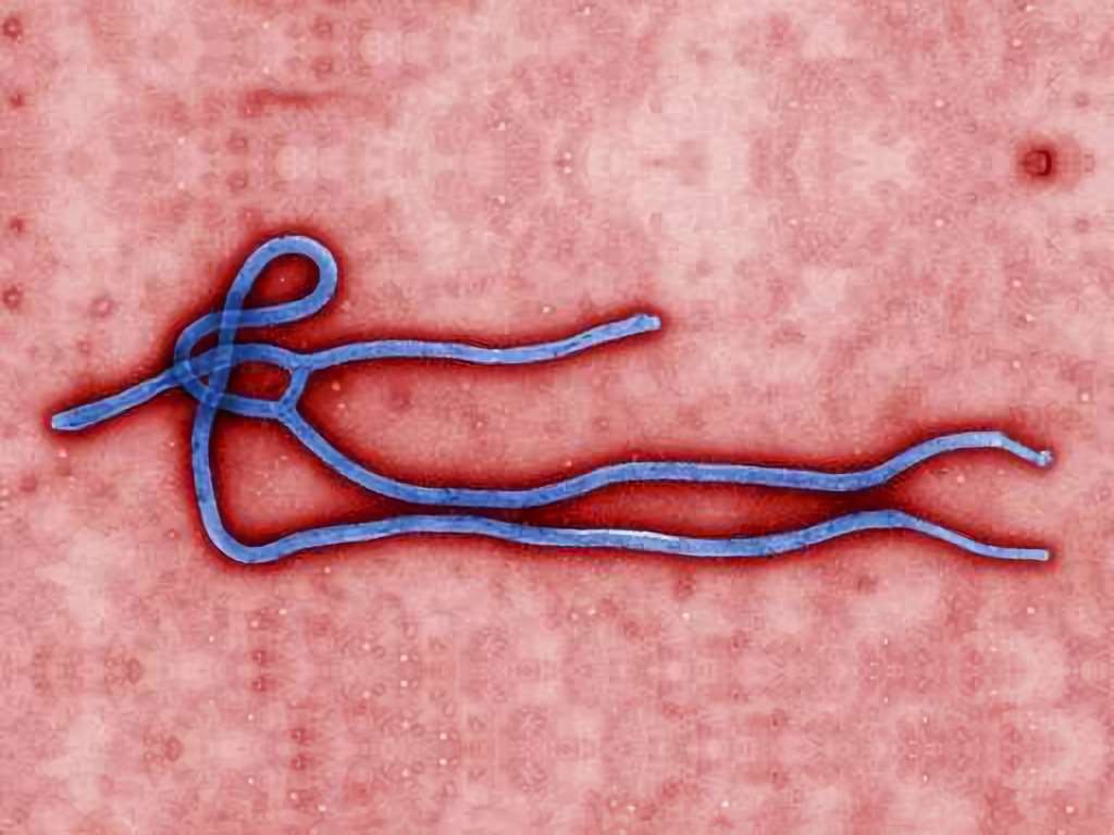 Ebola virus. (Public domain image from CDC)