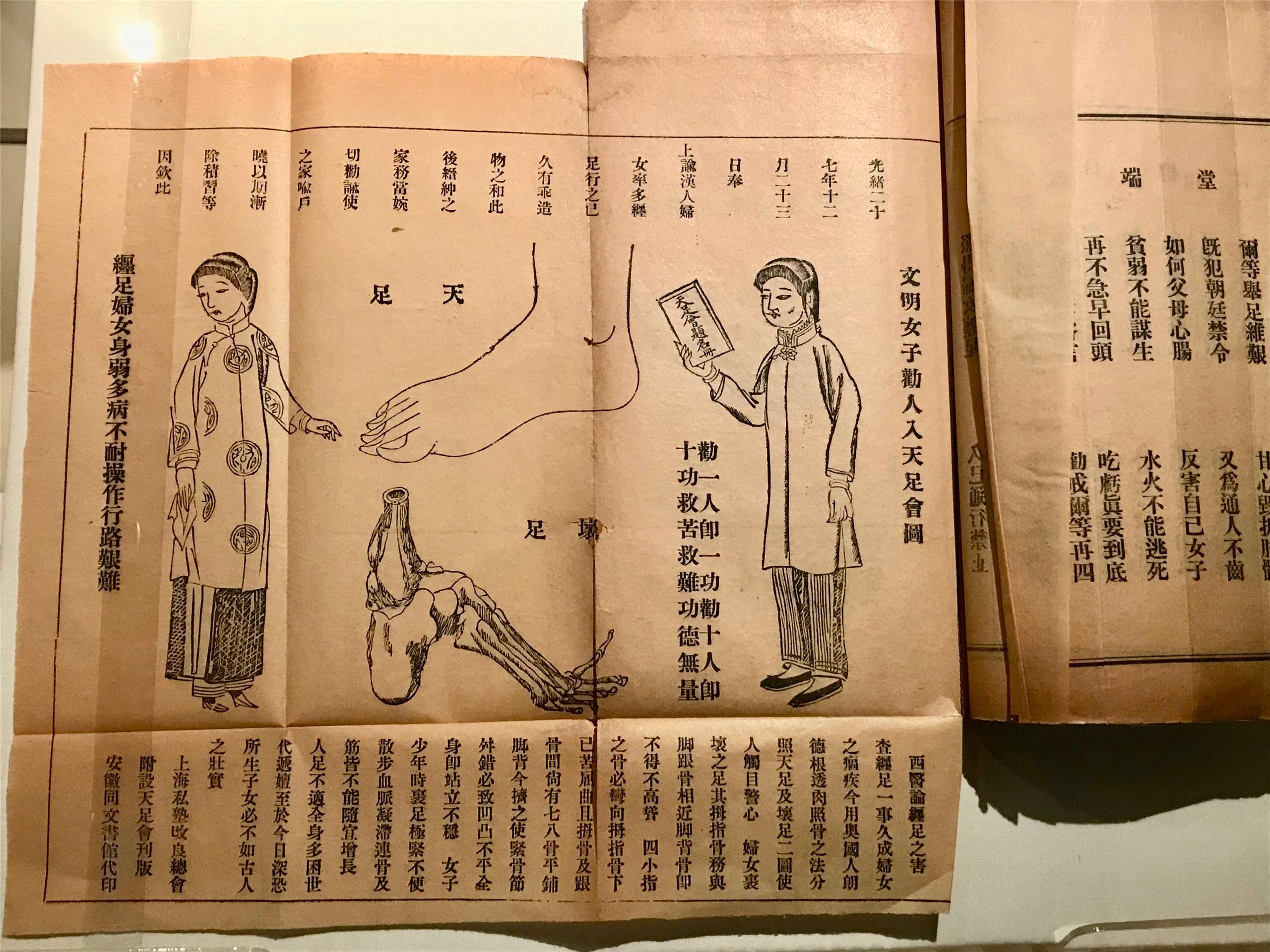 L'exposition consacrée à la pratique des pieds bandés au Musée de Beitou peut se visiter jusqu'au 16 novembre 2025 (Image : RTI / avec l'aimable autorisation du Musée de Beitou)