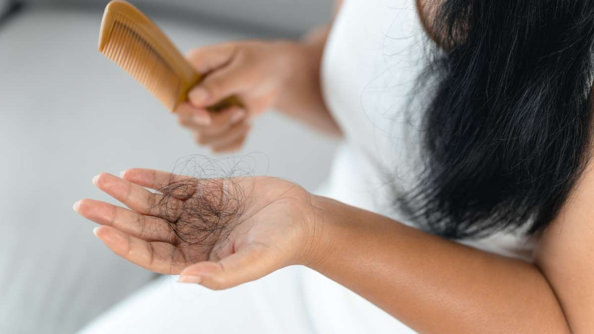 Ilustrasi rambut rontok (foto: UCLA Health)