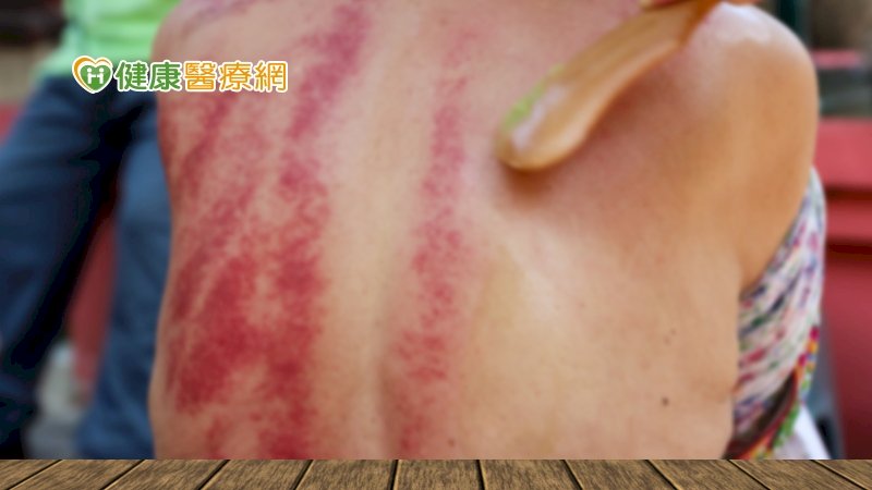 Guasha, photo from healthnews.com.tw
