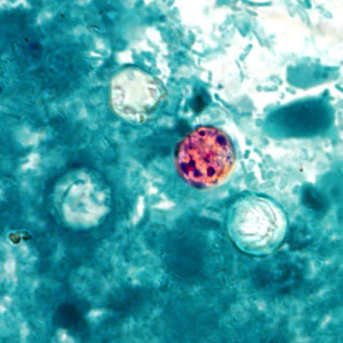 Cyclosporiasis (Larawan: Wikipedia)
Larawan ng parasite na nagdudulot ng sakit na cyclosporiasis. (Pinagmulan: Wikipedia)