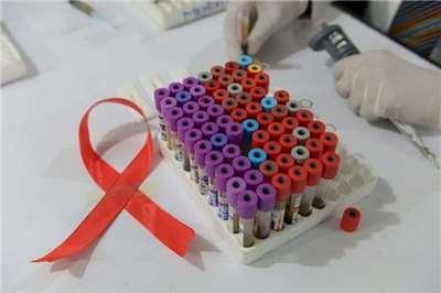 愛滋病毒(HIV)示意圖。