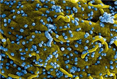 圖為顯微鏡下的馬堡病毒(Marburg virus)。