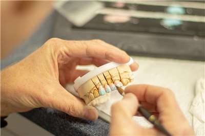 聯合國「汞水俁公約」締約國會議7日同意，在2034年前逐步淘汰在治療蛀牙時使用汞合金的填充物。示意圖。(圖：Pixabay)