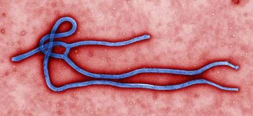 圖為伊波拉(Ebola)病毒。(CDC/Cynthia Goldsmith)(Public domain)