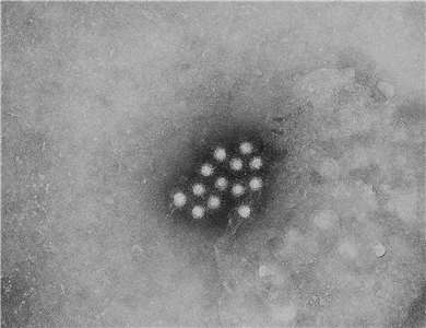 A型肝炎病毒 (CDC/Betty Partin, Public domain, Wikimedia Commons)
