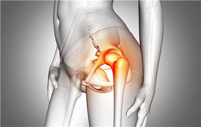 統計指出，台灣冬季髖部骨折發生率高於夏季20%。(示意圖/freepik)