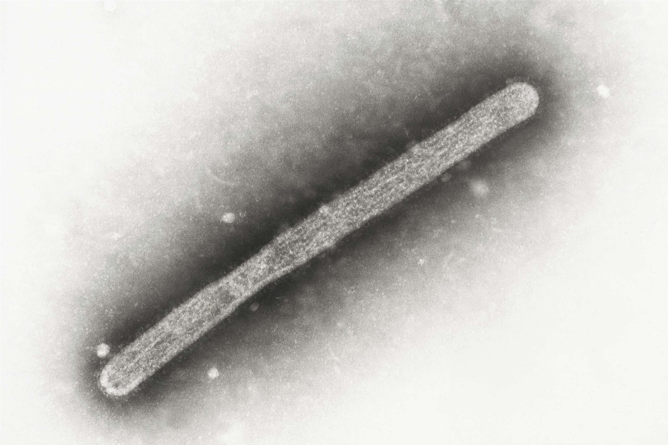 圖為電子顯微鏡下的禽流感H5N1病毒。資料照。