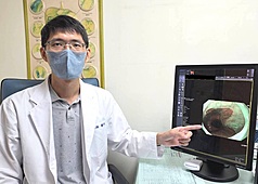 苗栗縣大千綜合醫院肝膽腸胃科醫師林德福30日指出，胃食道逆流是現代人常見疾病，胃酸長期侵蝕食道恐致食道癌，早期治療可遠離癌變危機。(大千醫院提供)