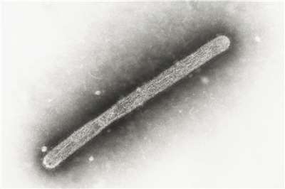 圖為電子顯微鏡下的禽流感H5N1病毒。資料照。