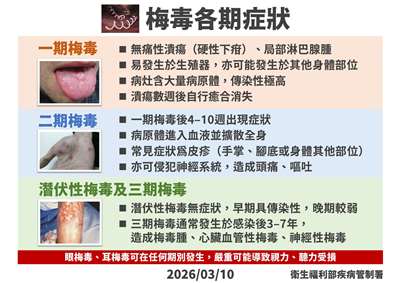 梅毒各期症狀。(疾管署提供)