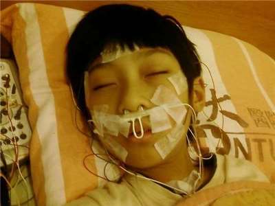 打鼾、暴牙、越睡越累？解開睡眠呼吸中止症的健康密碼！
