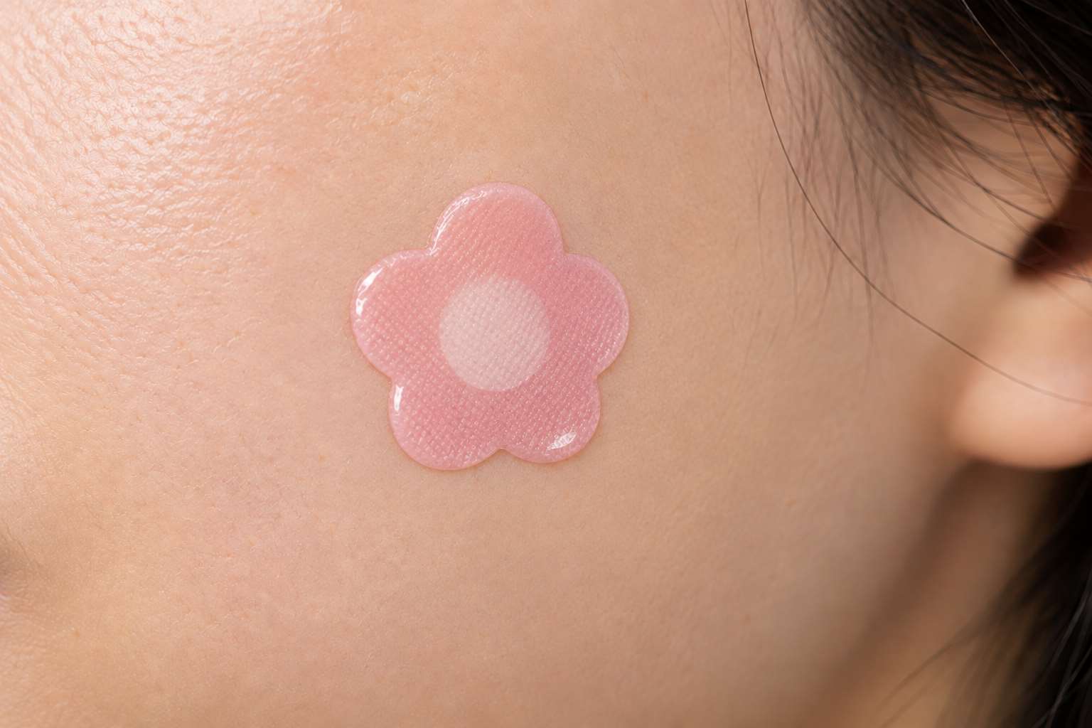 維他命貼片(Vitamin Patch)採用經皮吸收（Transdermal Delivery）概念，讓貼片中的成分逐步釋放，穿過皮膚外層後進入較深層組織及微血管。示意圖。(AI生成圖)