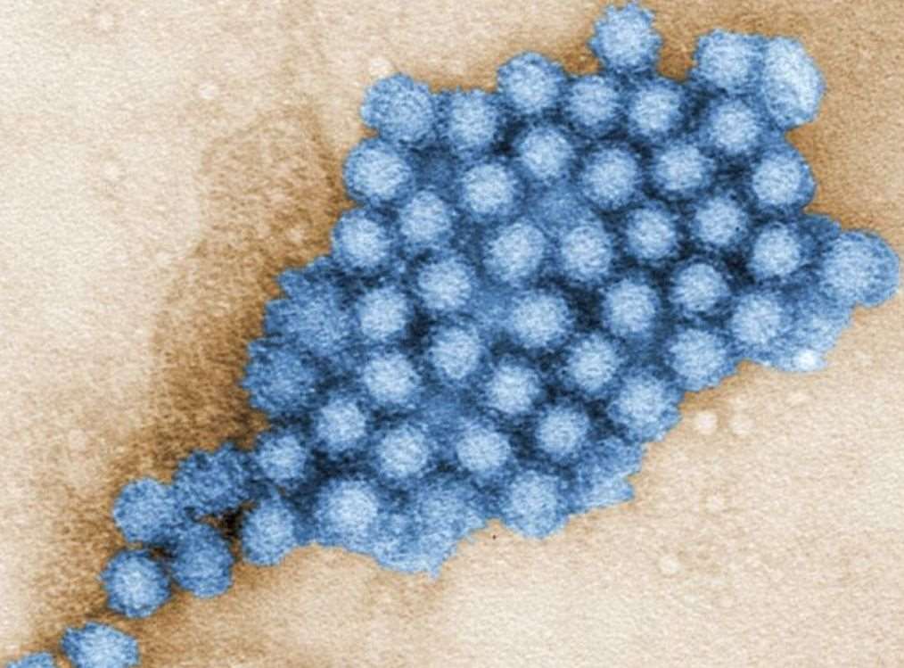 ตัวอนุภาคของไวรัสโนโร(photo:CDC)