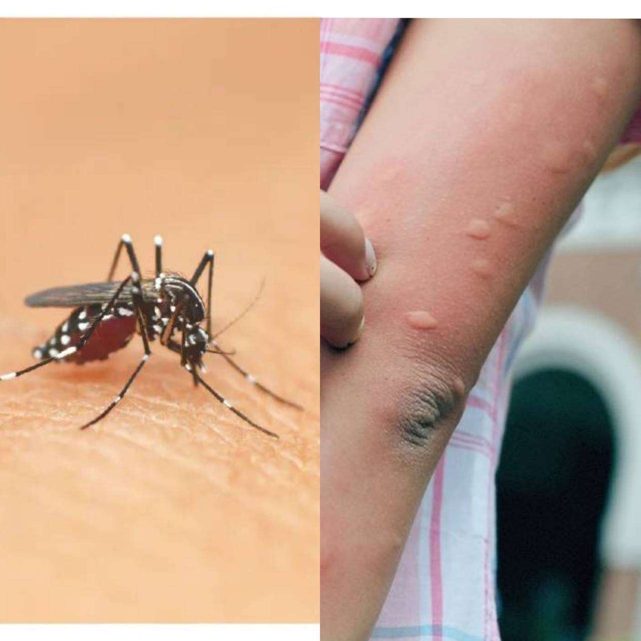  โรคไข้เลือดออกในไต้หวันพบการระบาดช่วงหน้าร้อน เกิดจากการติดเชื้อไวรัสเดงกี โดยมียุงลายเป็นพาหะนำโรค ผู้ติดเชื้ออาจมีไข้สูง ผื่นที่ผิวหนัง ปวดศีรษะ ปวดกล้ามเนื้อ และปวดกระดูก(ภาพจาก primeplus-ww.tw)