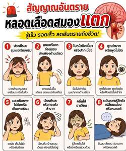 สัญญาณเตือนหลอดเลือดในสมองแตก