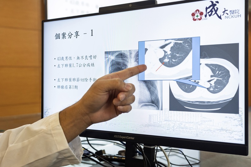 Ảnh minh họa (Bệnh viện Đại học Thành Công cung cấp)