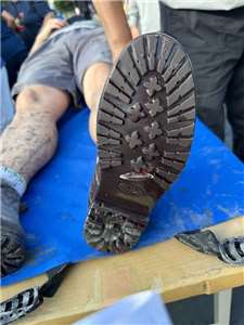 Mảnh thủy tinh lớn đâm thủng đôi giày chống trượt đế dày của một người dân. (Ảnh: Bệnh viện Từ Tế Hoa Liên/CNA)