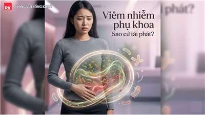 (Hình minh họa: AI)
